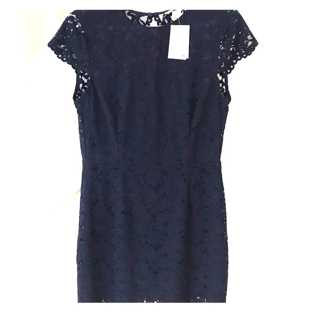 HM dress